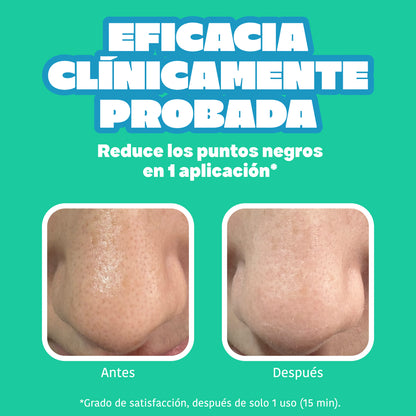 Tiras Nariz BYE BYE Dirty Pores