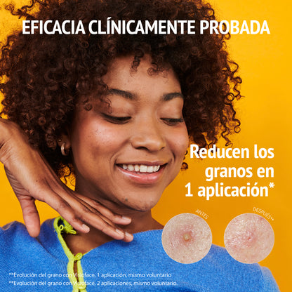 Parches Granos PRIDE con Ácido Salicílico